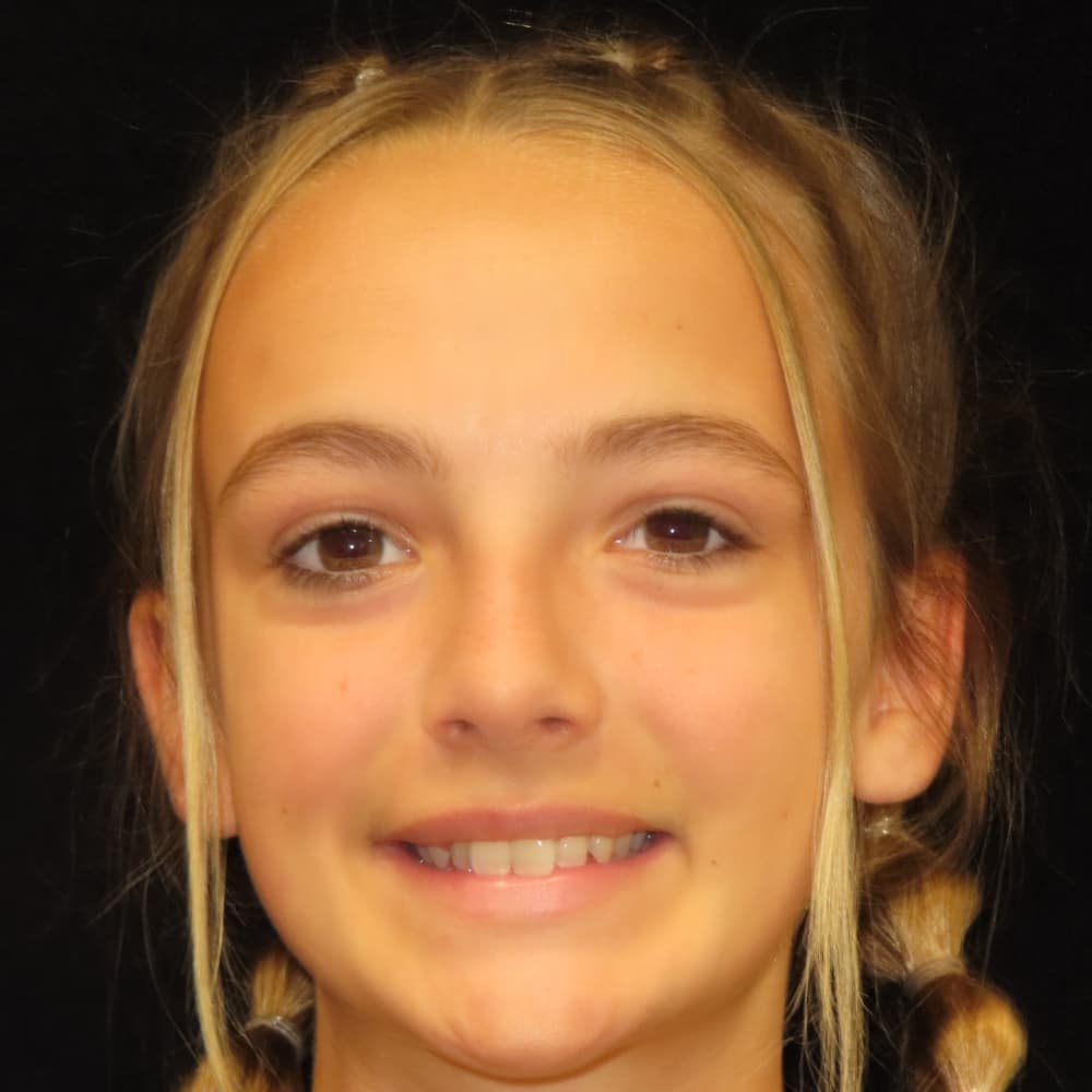 before Image
