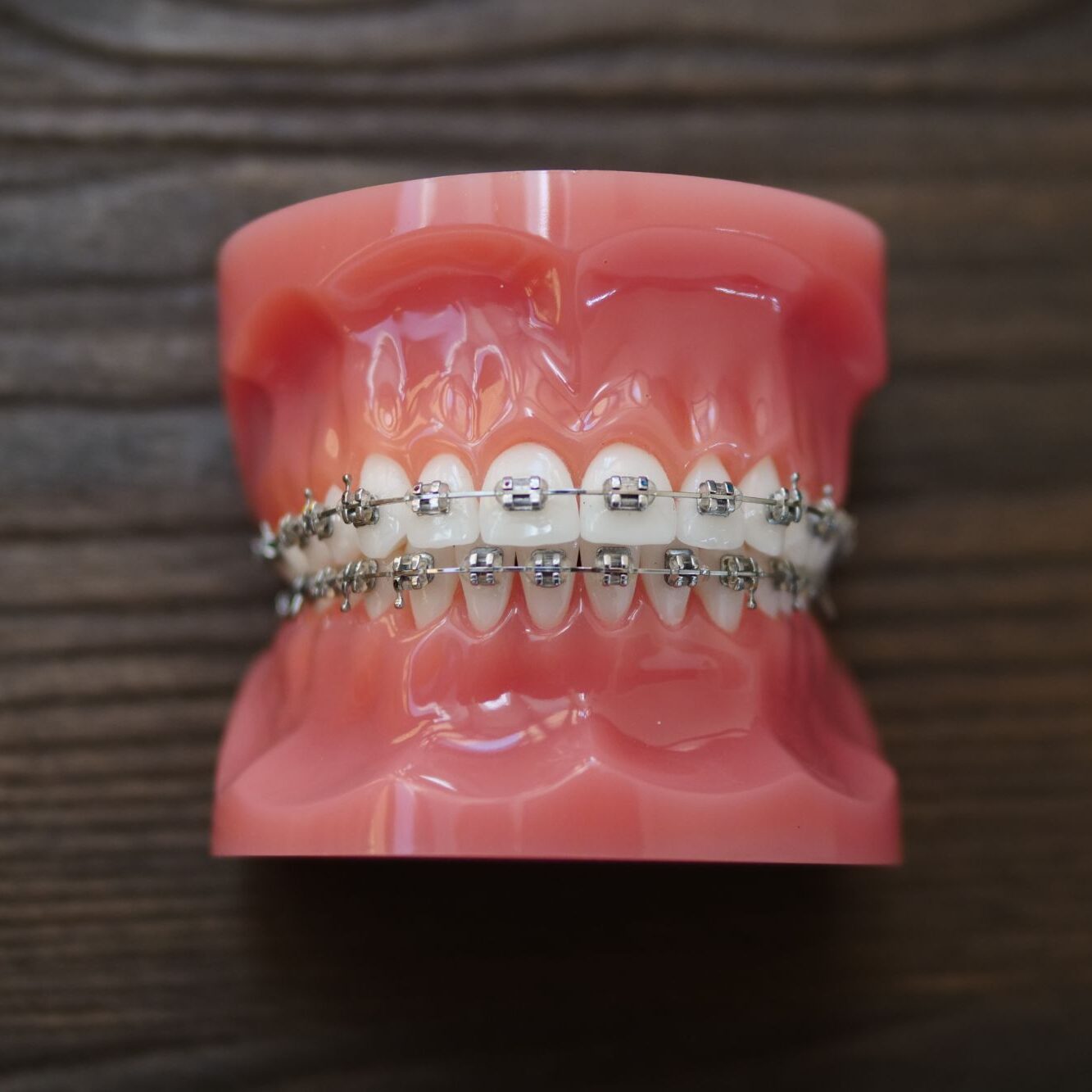 metal braces